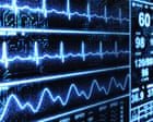 ‘Superhuman’ AI tool spots heart disease in less than 2 seconds