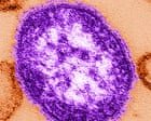 Six-week-old child in Pennsylvania dies from measles, coroner says