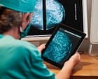 AI will help find cure for cancer ‘within our lifetimes’, says Arm Holdings chief